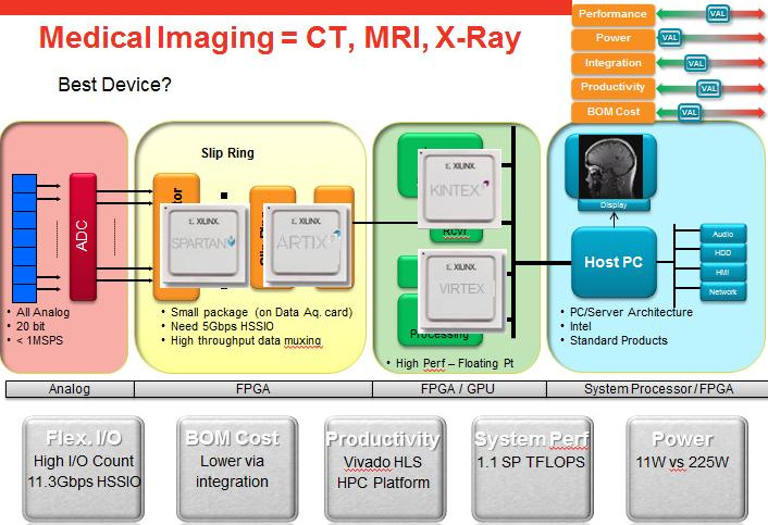 Xilinx 7系列FPGA在醫(yī)療成像方面的應用