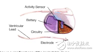 更小，更聰明，Ultra Low Power傳感器提高了醫(yī)用植入物能量收集的潛力