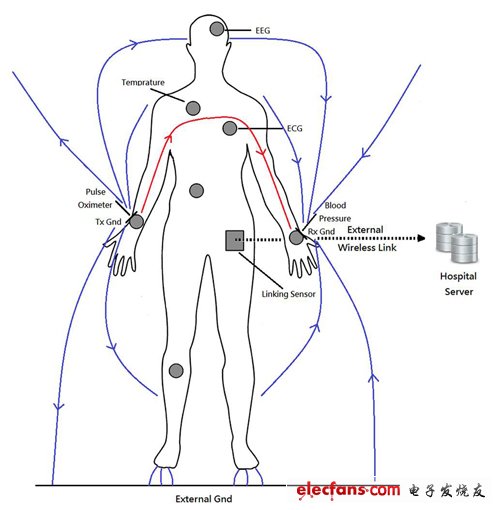 圖1 人體醫(yī)療監(jiān)控網路示意圖
