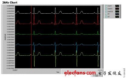 圖3. 連接病人仿真器的ADAS1000屏幕截圖，心率 = 70 BPM