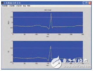 基于生物反饋技術的可穿戴式心電監(jiān)測系統(tǒng)的設計