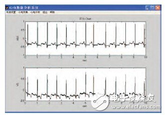 基于生物反饋技術的可穿戴式心電監(jiān)測系統(tǒng)的設計