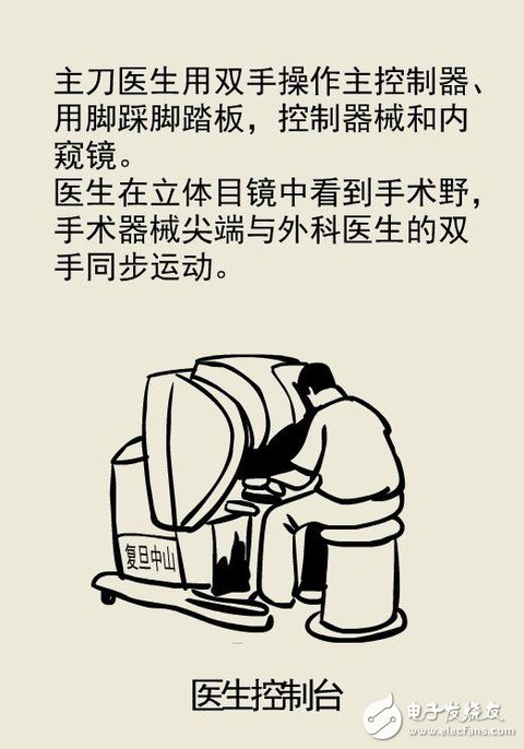 全球最先進(jìn)的達(dá)芬奇手術(shù)機(jī)器人技術(shù)解析 