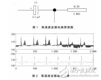 心電信號(hào)濾波器的設(shè)計(jì)