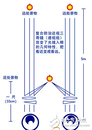 光學(xué)預(yù)防的定義與防治眼鏡的介紹
