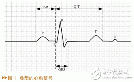 如何設(shè)計(jì)一個(gè)基于MATLAB/SIMULINK的心電信號(hào)仿真方法？