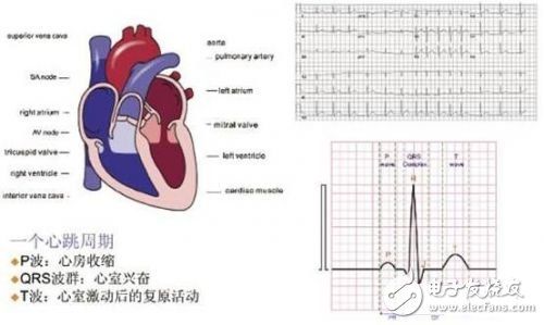 利用ECG AFE簡化病人監(jiān)護儀設(shè)計